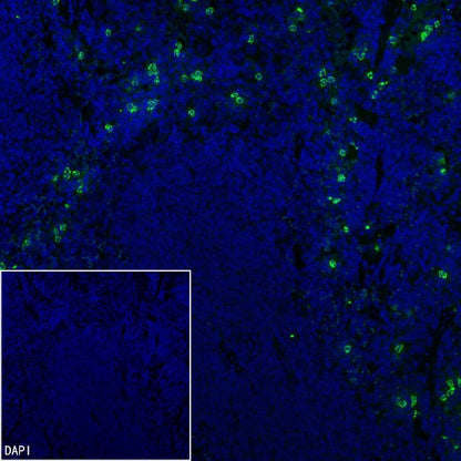 Lipocalin-2/NGAL Recombinant Rabbit mAb (S-2280-129)