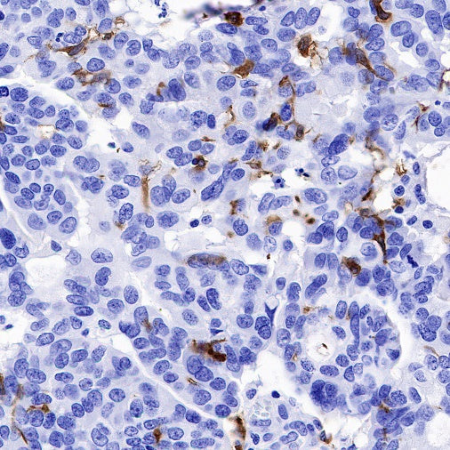 CD1a Recombinant Rabbit mAb (S-1486-65)