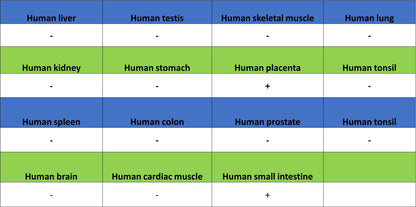 NOD2 Recombinant Rabbit mAb (SDT-3245-112)