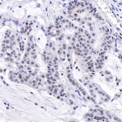 Nucleophosmin/NPM Recombinant Rabbit mAb (S-R231)