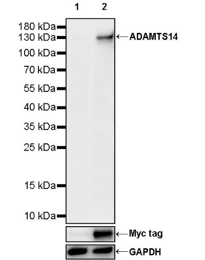 ADAMTS14 Recombinant Rabbit mAb (S-2935-69)