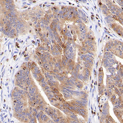 Ezrin Recombinant Rabbit mAb (S-1894-4)