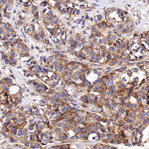 PSEN1 Recombinant Rabbit mAb (S-1002-129)