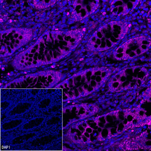 Stat6 Recombinant Rabbit mAb (Alexa Fluor® 647 Conjugate) (SDT-337-32)