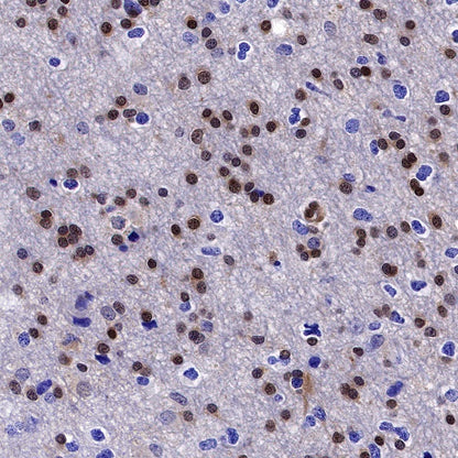 MGMT Recombinant Rabbit mAb (SDT-522-71)