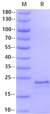 KRAS(Q61H) His Tag Protein, Human