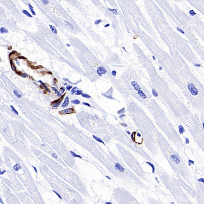 TAGLN/Transgelin Recombinant Rabbit mAb (S-1715-59)