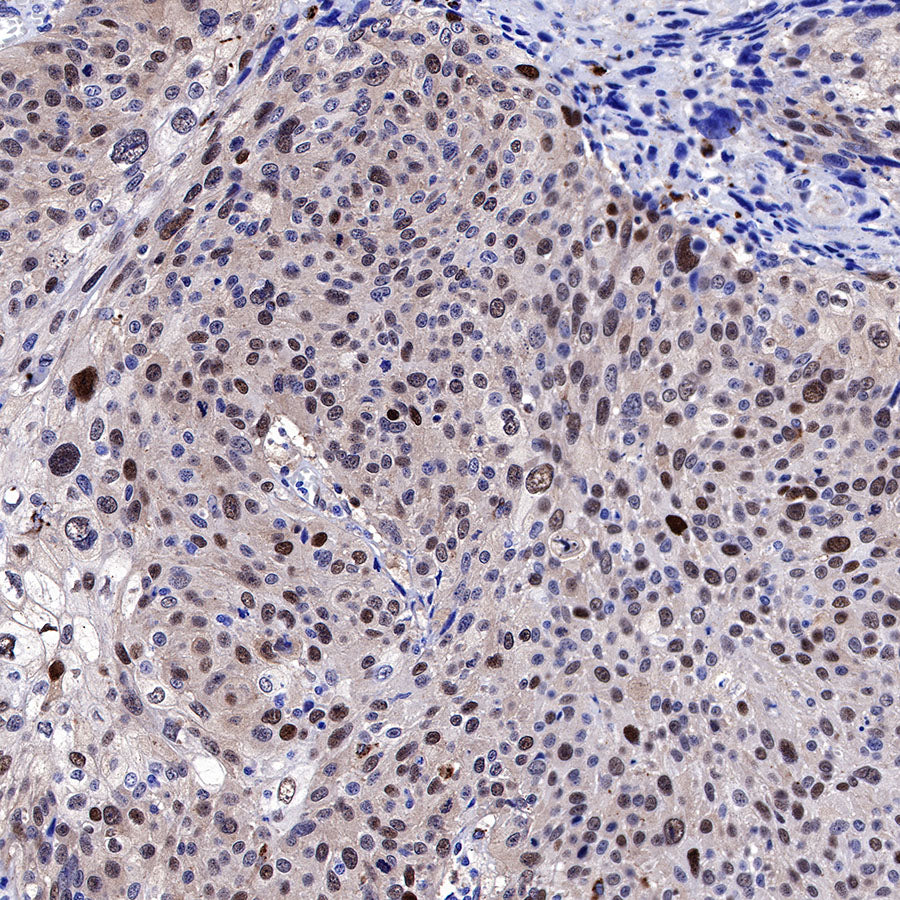 CDK2 Recombinant Rabbit mAb (SDT-064-40)