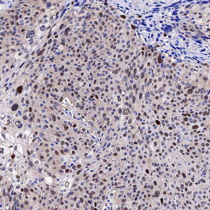 CDK2 Recombinant Rabbit mAb (SDT-064-40)
