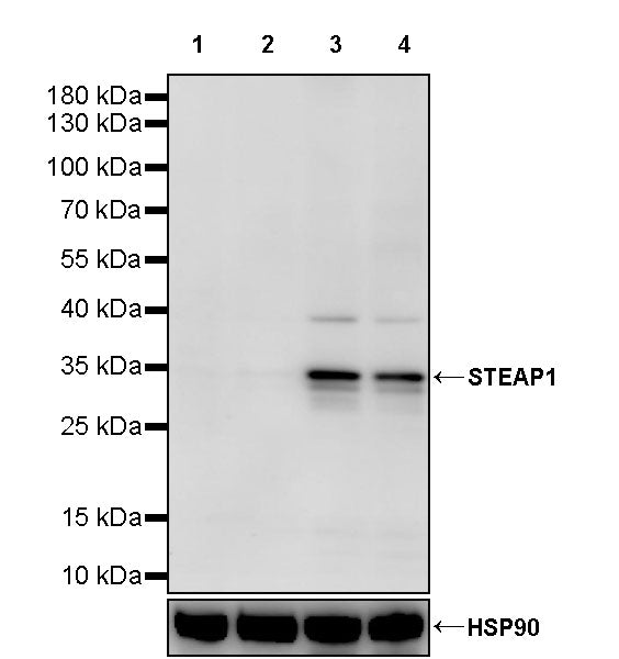 STEAP1 Recombinant Rabbit mAb (S-3613-107)