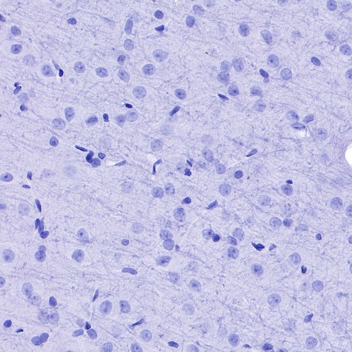 S-RMab®Rabbit mAb IgG Isotype Control (S-R058)
