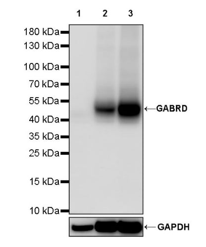 GABRD Recombinant Rabbit mAb (S-1584-162)