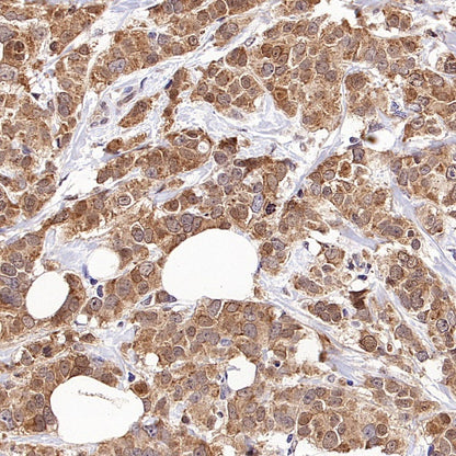 SMAD3 Recombinant Rabbit mAb (S-3147-36)