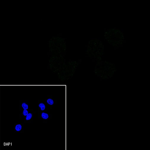 SMAD4 Recombinant Rabbit mAb (SDT-168-62)