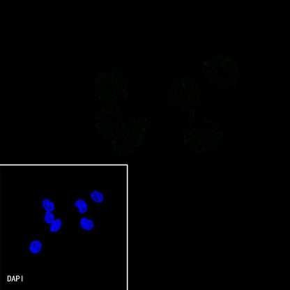 SMAD4 Recombinant Rabbit mAb (SDT-168-62)