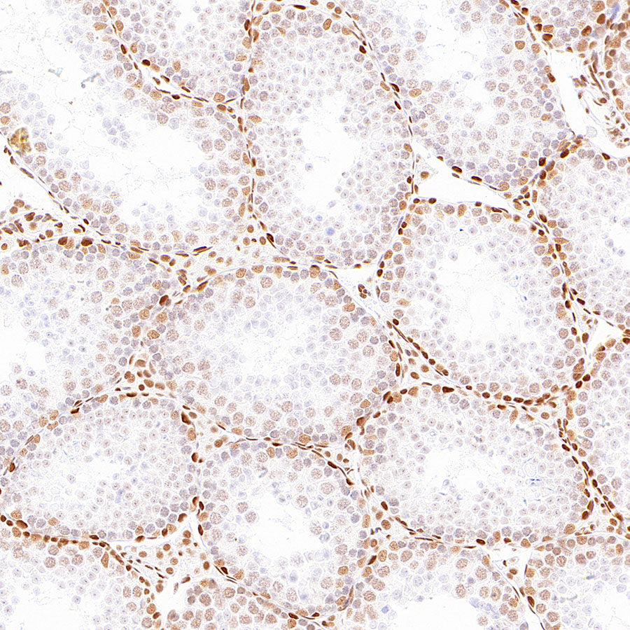 pan Brd4 Recombinant Rabbit mAb (S-6208)