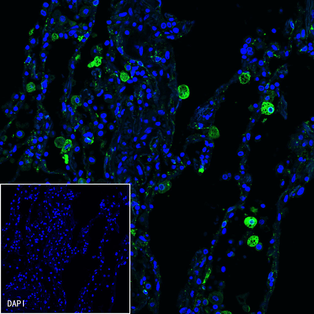 iNOS Recombinant Rabbit mAb (SDT-R131)