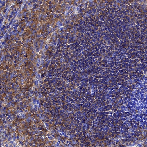 BTK Recombinant Rabbit mAb (SDT-2105-37)