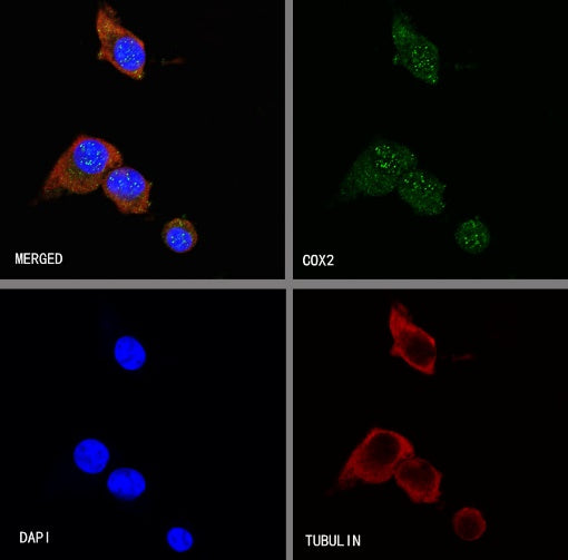 COX2 Recombinant Rabbit mAb (SDT-380-259)