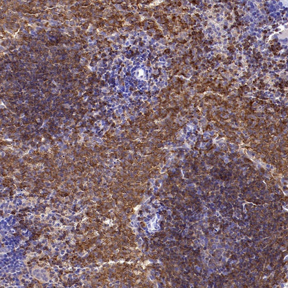 BANK1 Recombinant Rabbit mAb (SDT-2265-37)