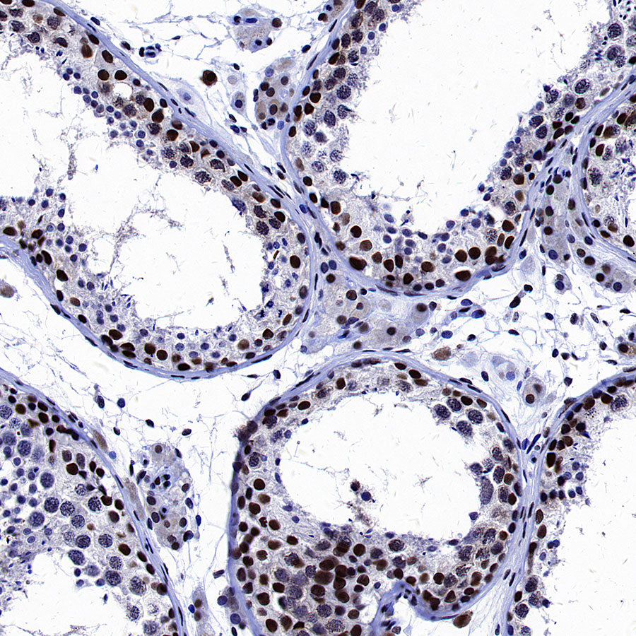 p300 Recombinant Rabbit mAb (S-2612-122)