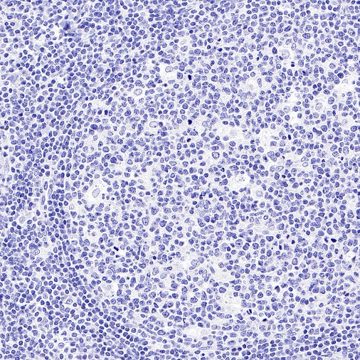Mouse mAb IgA, κ Isotype Control (S-844-79-1)