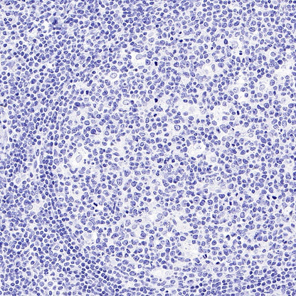 Mouse mAb IgA, κ Isotype Control (S-844-79-1)