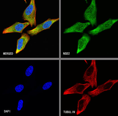 NSD2 Recombinant Rabbit mAb (S-4013-46)