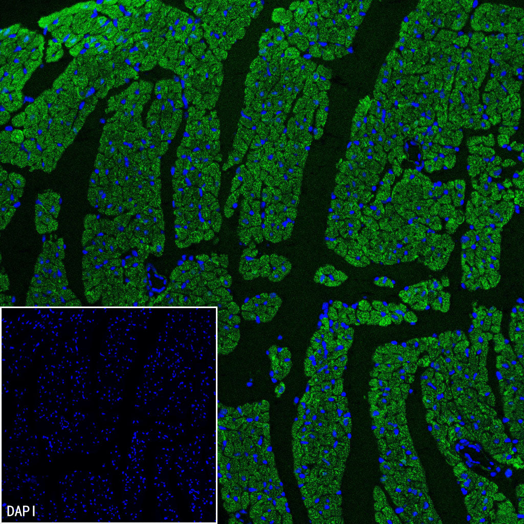 CHCHD10 Recombinant Rabbit mAb (S-4106-13)