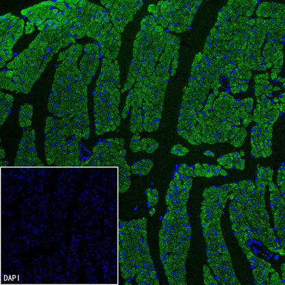 CHCHD10 Recombinant Rabbit mAb (S-4106-13)