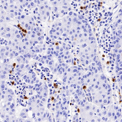 CXCR2 Recombinant Rabbit mAb (S-1292-30)