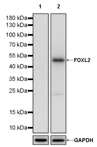 FOXL2 Recombinant Rabbit mAb (SDT-557-361)