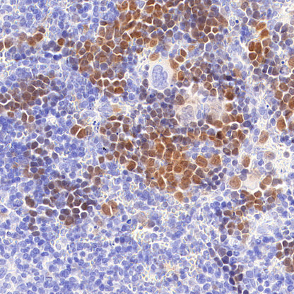 Chk1 Recombinant Mouse mAb (S-6263)