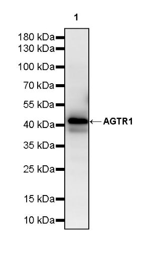 AGTR1 Recombinant Rabbit mAb (S-2447-22)