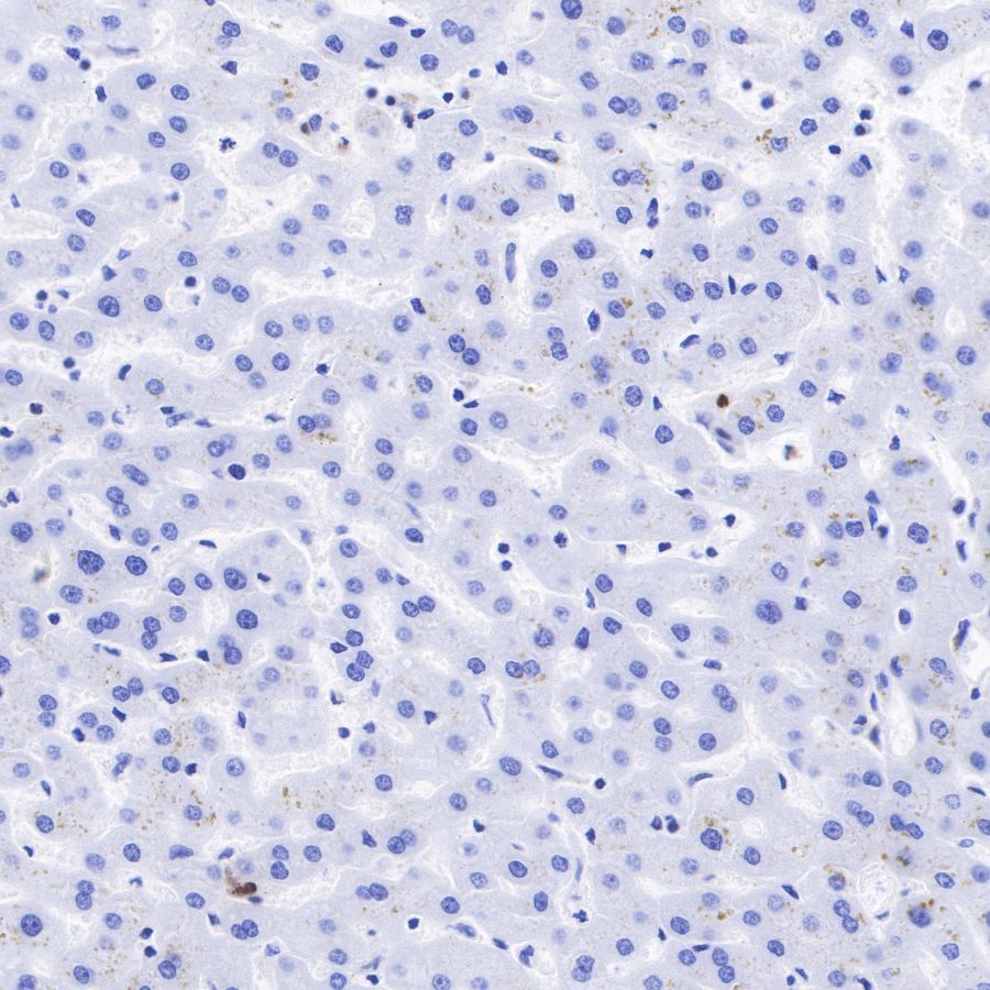AFP Recombinant Rabbit mAb (SDT-R031)