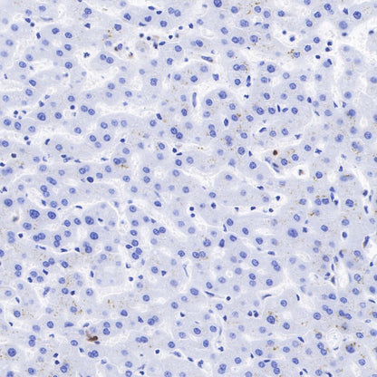 AFP Recombinant Rabbit mAb (SDT-R031)