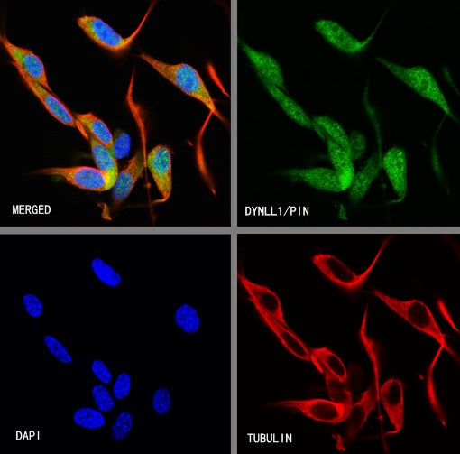 DYNLL1/PIN Recombinant Rabbit mAb (S-1460-8)