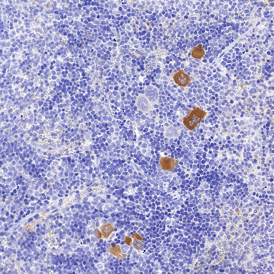 PD-L1 Recombinant Rabbit mAb (S-3933-78)
