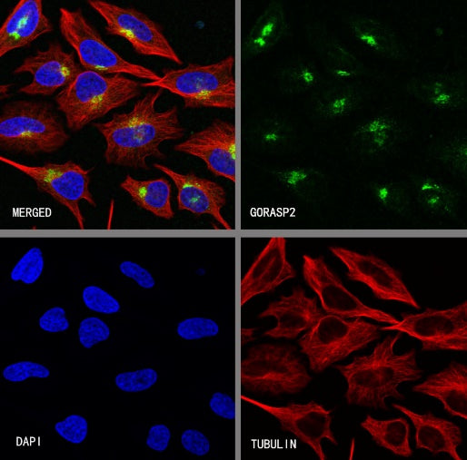 GORASP2 Recombinant Rabbit mAb (S-2526-47)