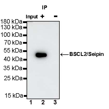 BSCL2/Seipin Recombinant Rabbit mAb (S-1669-46)