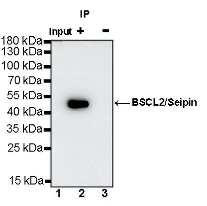 BSCL2/Seipin Recombinant Rabbit mAb (S-1669-46)