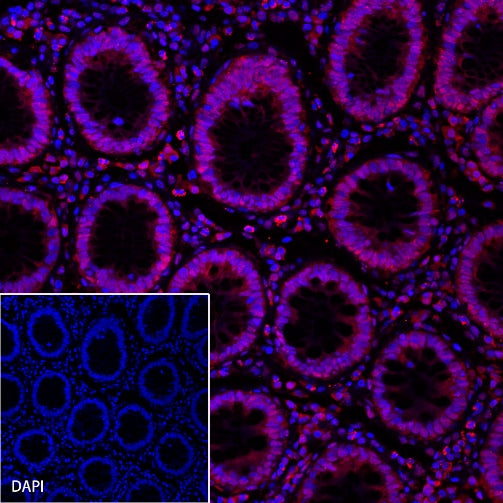 MSH6 Recombinant Rabbit mAb (Alexa Fluor® 555 Conjugate) (SDT-R094)