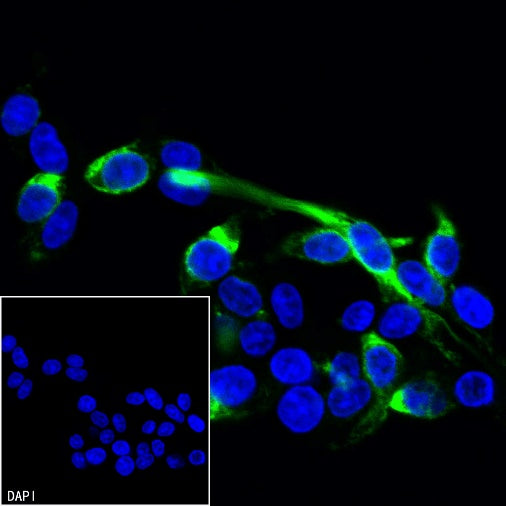Vimentin Recombinant Rabbit mAb (Alexa Fluor® 488 Conjugate) (S-029-20)