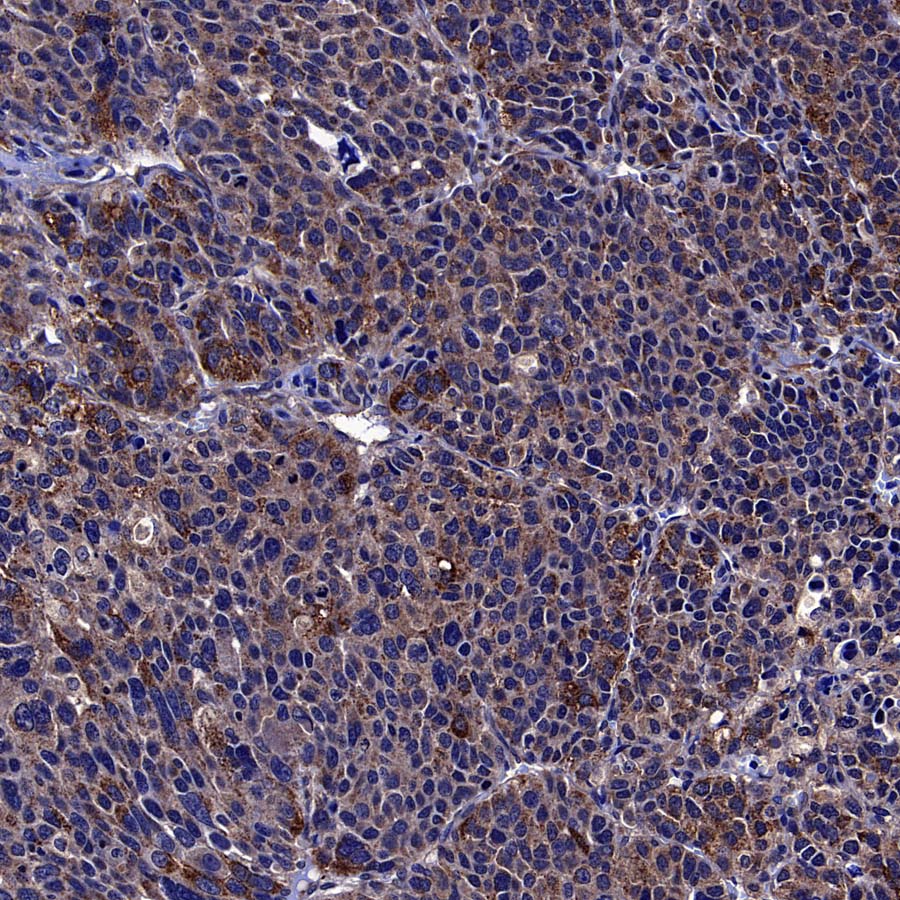 MMP3 Recombinant Rabbit mAb