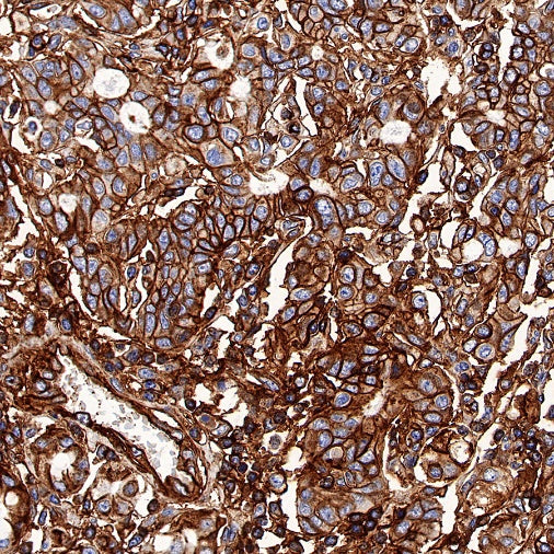 HLA-E Recombinant Rabbit mAb (S-1081-62)
