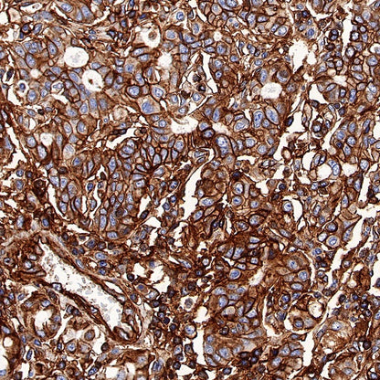 HLA-E Recombinant Rabbit mAb (S-1081-62)