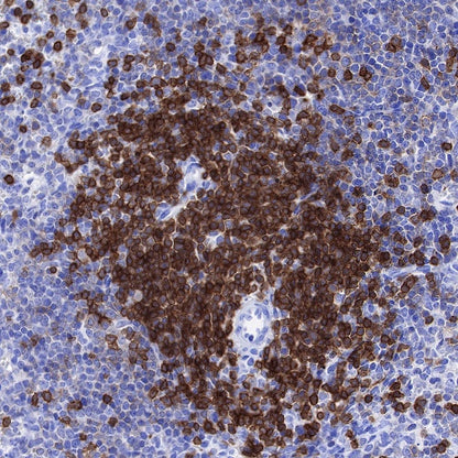 Lck Recombinant Rabbit mAb (SDT-316-15)