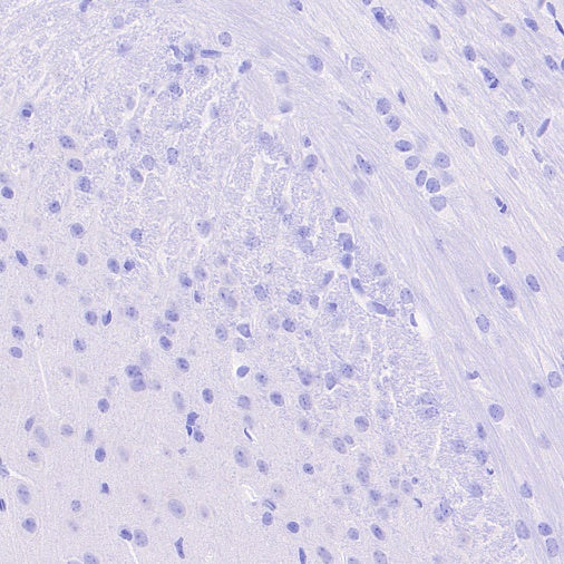 CD42a Recombinant Rabbit mAb (S-2705-46)