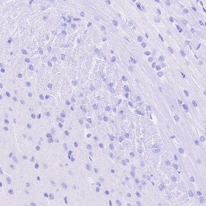 CD42a Recombinant Rabbit mAb (S-2705-46)