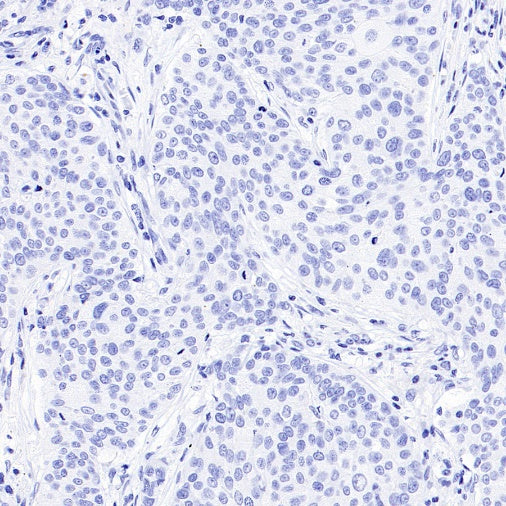 MDR3 Recombinant Rabbit mAb (SDT-1949-60)